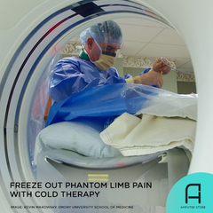 Image-guided cryoablation or cold therapy is a promising treatment for reducing phantom limb pain.