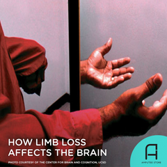 Mirror box therapy can retrain the brain to stop phantom limb pain.