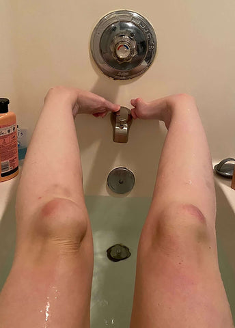 CrossFit adaptive athlete Maggie Rath's legs before amputation