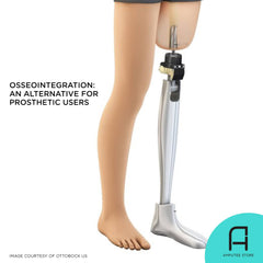 Osseointegration, a bone implant procedure, is deemed to be the future of prosthetics.