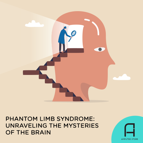 Scientists are investigating the role of the brain in phantom limb syndrome.