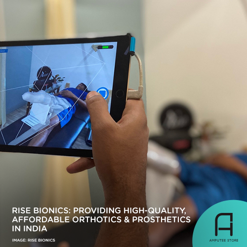 Rise Bionics provides high-quality yet affordable prosthetics and orthotics in India.