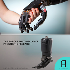The forces that influence prosthetic research.
