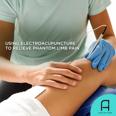 Electroacupuncture is a promising treatment for phantom limb pain.