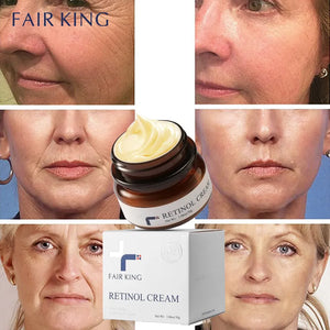 Retinol Cream Anti-Aging Wrinkle Lightening Whitening Spots Accelerated Skin Renewal and Shrinking Pore - yveyx2