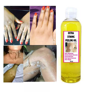 Yellow peeling oil strong yellow peeling oil Lighten elbows knees hands melanin even skin tone and whiten skin - Limbarosestore