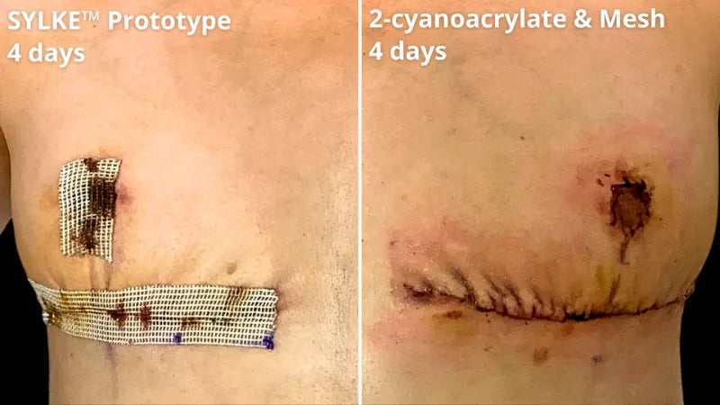 1 sylke before after showing the prevention of allergic dermatitis.webp__PID:d722ce3f-30b9-4e82-bf49-0d0ba0bbb448