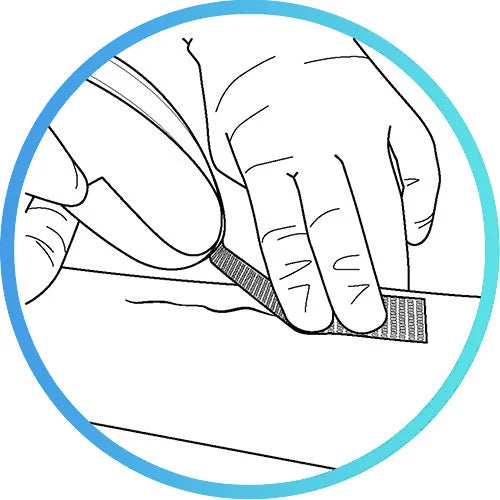 placing strip on patient wound visuall.webp__PID:dfb4858d-627b-4887-997f-f21799fdfa86