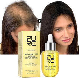 PURC Fast Hair Growth for Men Women Ginger Grow Hair Oil Care Anti Hair Loss Scalp Treatment Serum Products Beauty Health 2023 - Pain Point Goods