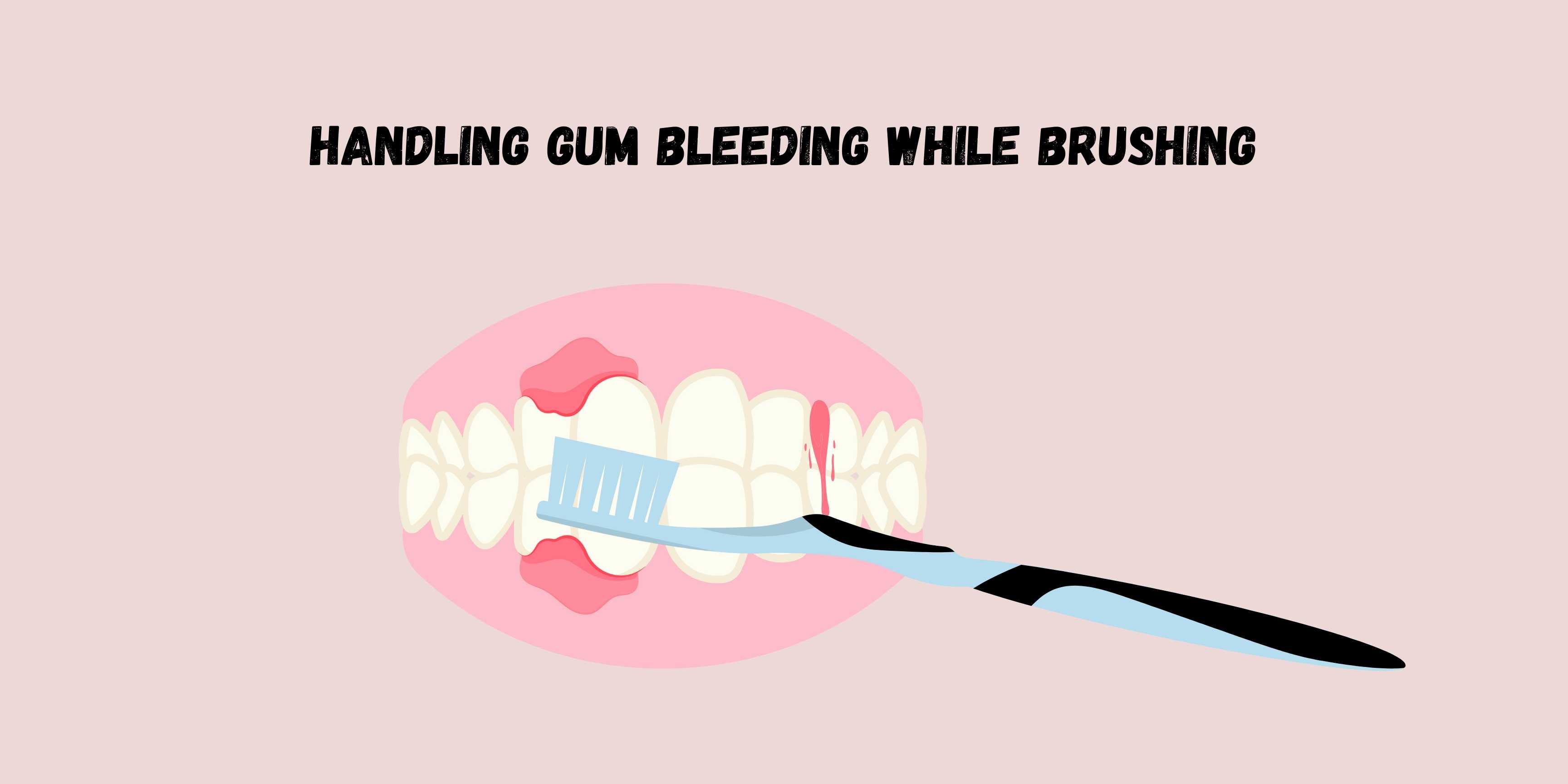 Handling Gum Bleeding While Brushing