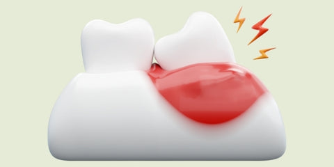 Understanding Bleeding Gums