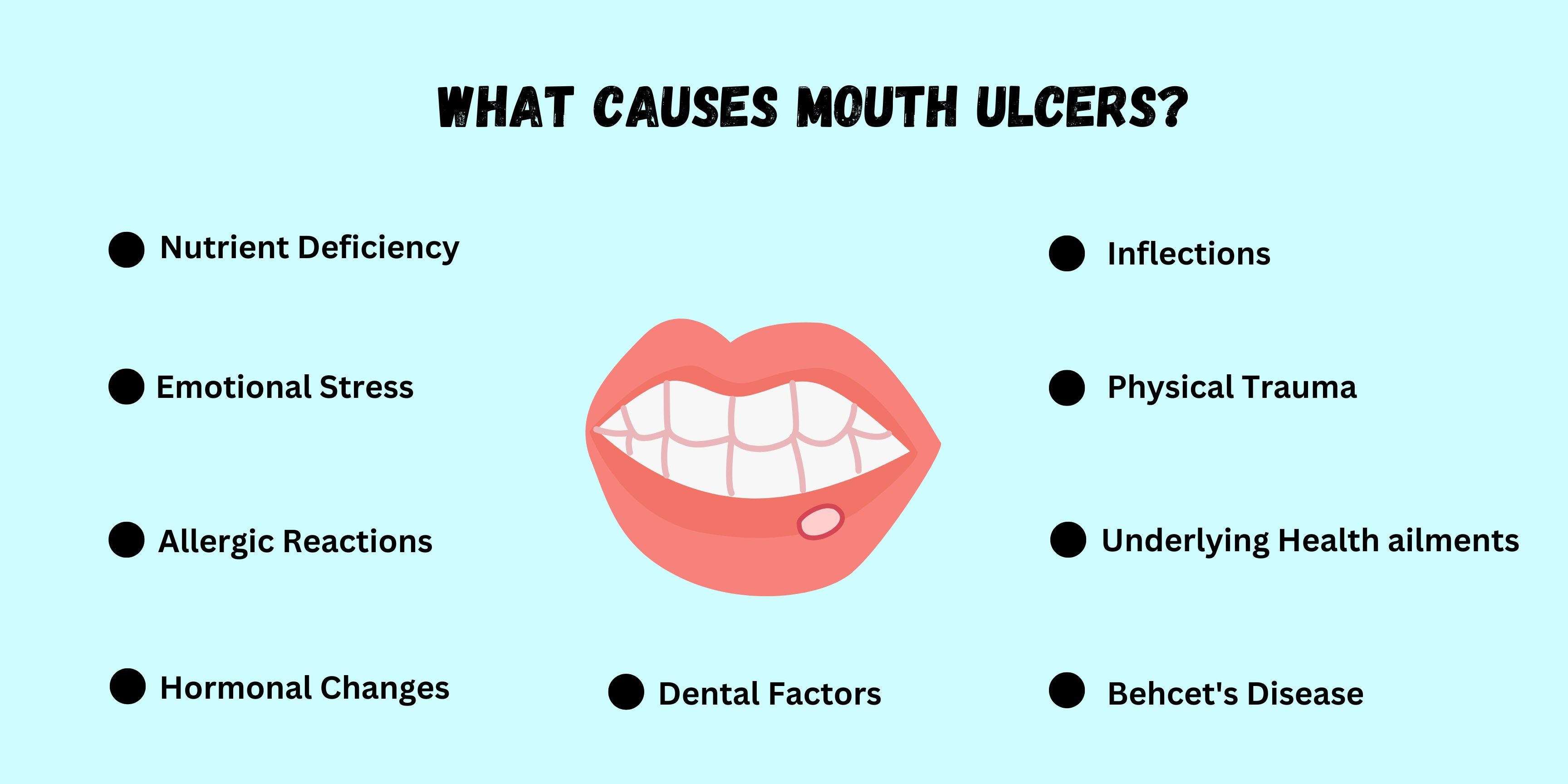 What Causes Mouth Ulcers
