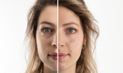 Women good skin before and after