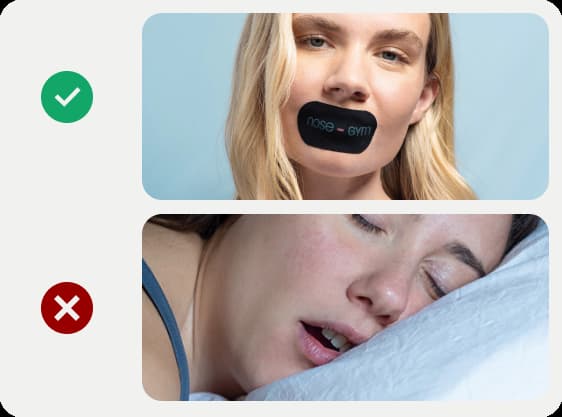 A person using a nose breathing trainer vs. a person sleeping with an open mouth.