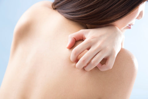 eczema