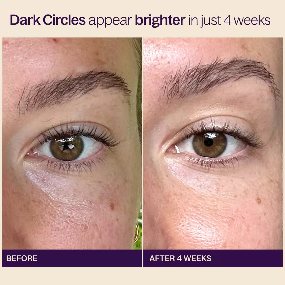 Before & After with Reduced Dark Circles with the Early Riser Eye Cream
