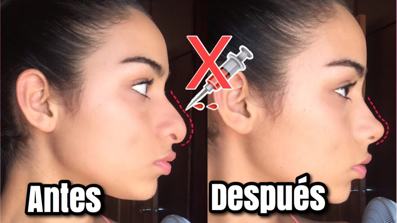 Corrector Nasal-Beauty Nose™ 🤩