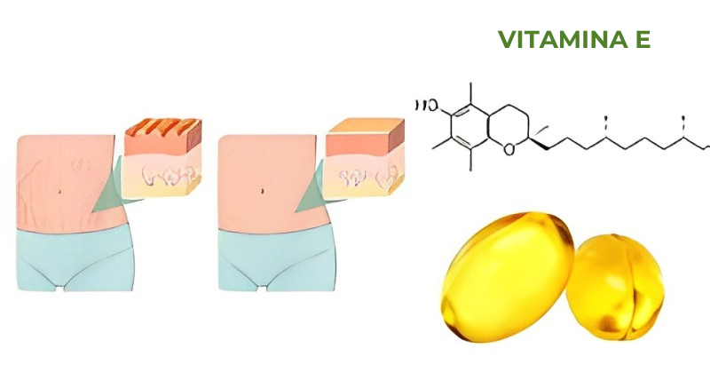 VITAMINA E.png__PID:48f2c69d-70f3-434a-8db7-2b4dfbefc0b4