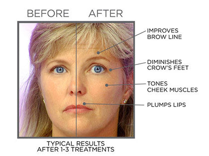 facemaster anti aging szérum