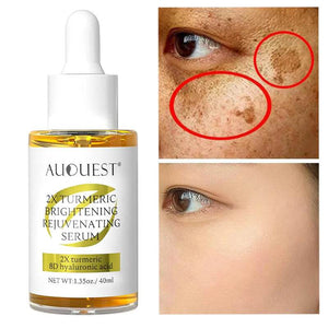 AUQUEST Dark Spot Serum Hyaluronic Acid Whitening Vitamin C Face Serum Turmeric Collagen Facial Skin Care Beauty - Tamnz