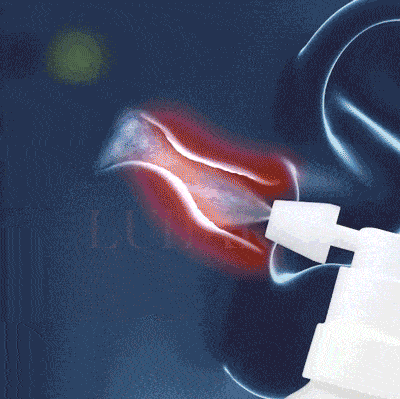 lavagem no ouvido limpeza no ouvido rémedio de ouvido alívio instantâneo do zumbido remedio zumbido ouvido remedio para zumbido ouvido zumbido ouvido remedio remedio para zumbido