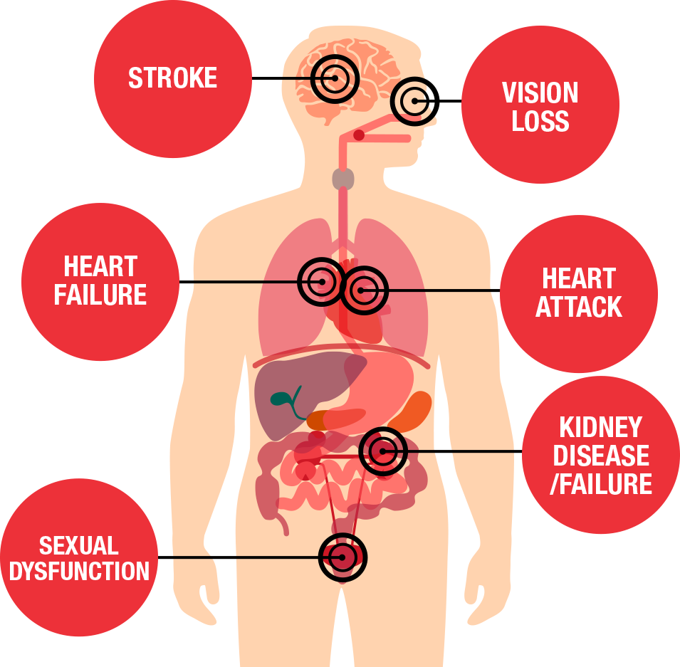 blood-pressure-disease.png