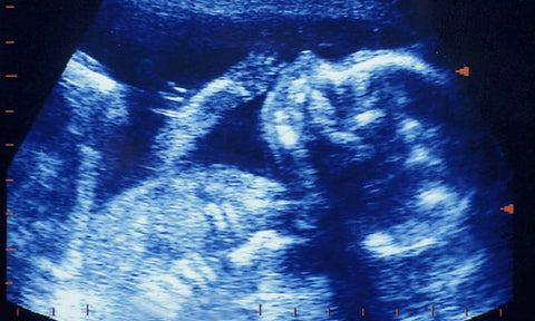 mens sperm quality decreasing with age