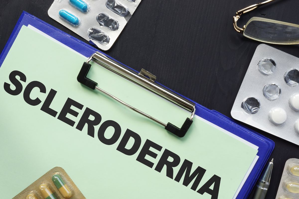 Scleroderma written on a medical clip board