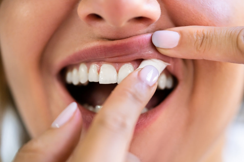 Image of a person placing a nicotine pouch under their lip