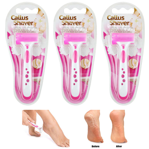 Gotyou Callus Remover Hard Dead Skin Corn Cutter Shaver Pedicure