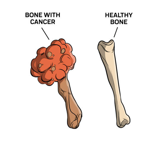 Symptoms of Cat Bone Cancer