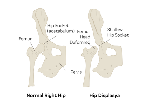 signs of hip dysplasia