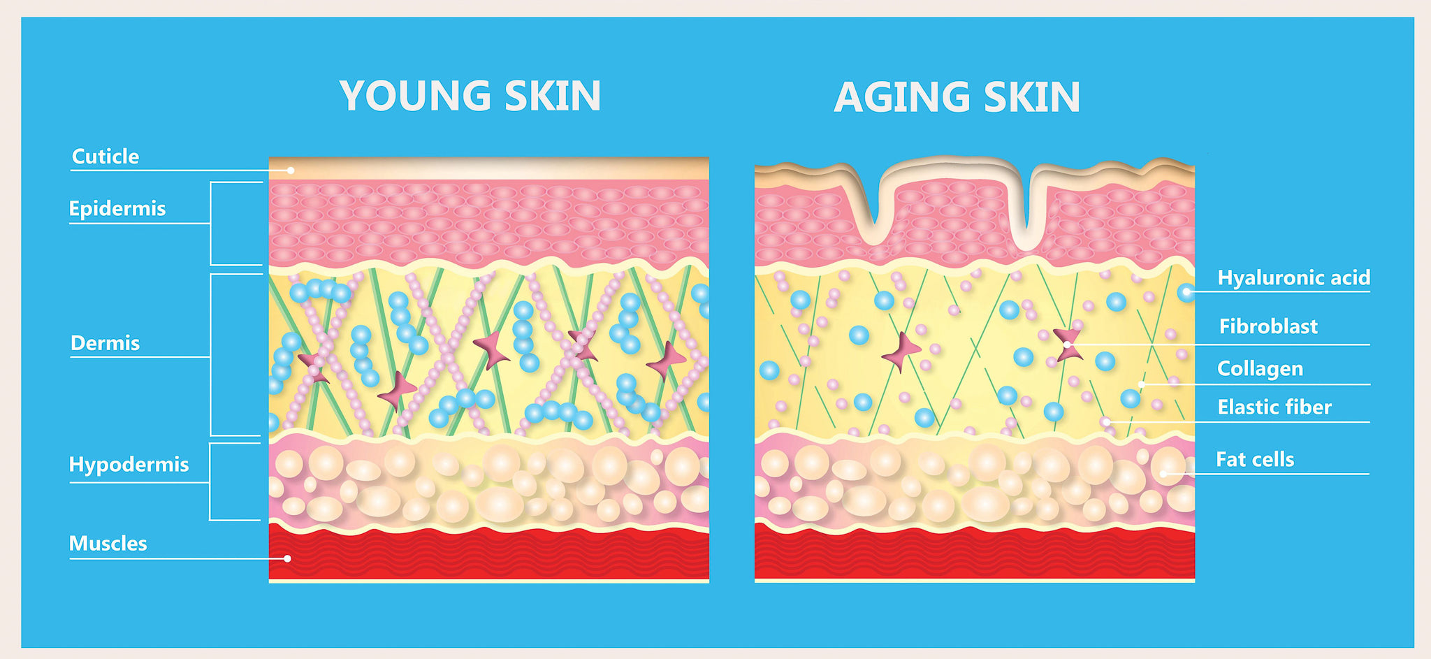 itsthefizz_collagen_skin_difference-2