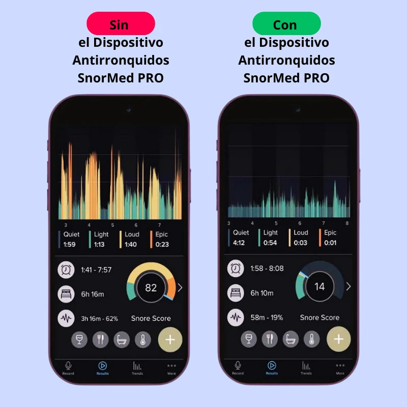Dispositivo antirronquidos SnorMed™ PRO
