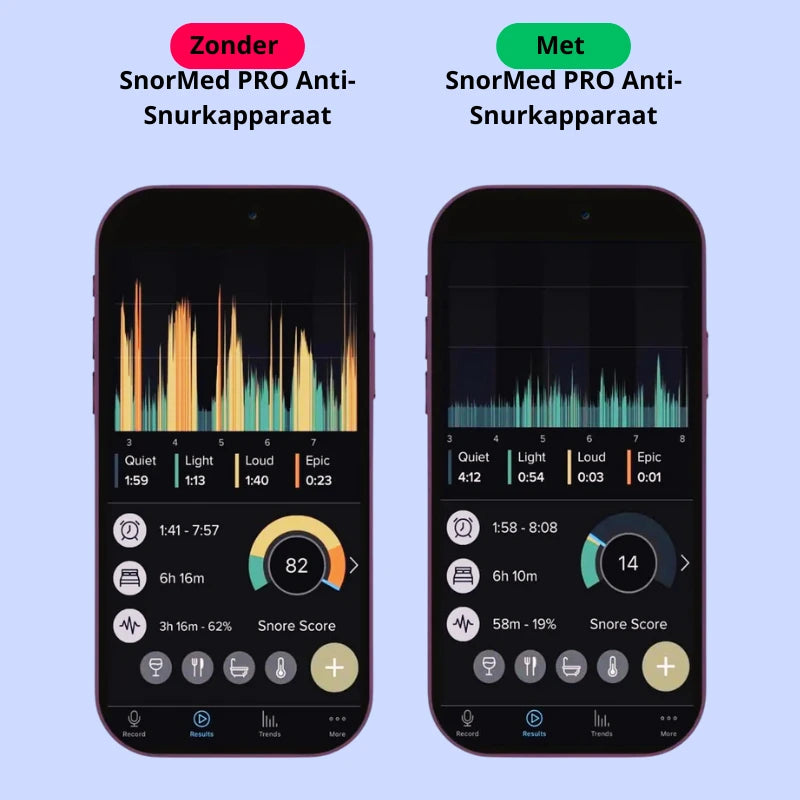 SnorMed™ PRO Anti-Snurk Apparaat