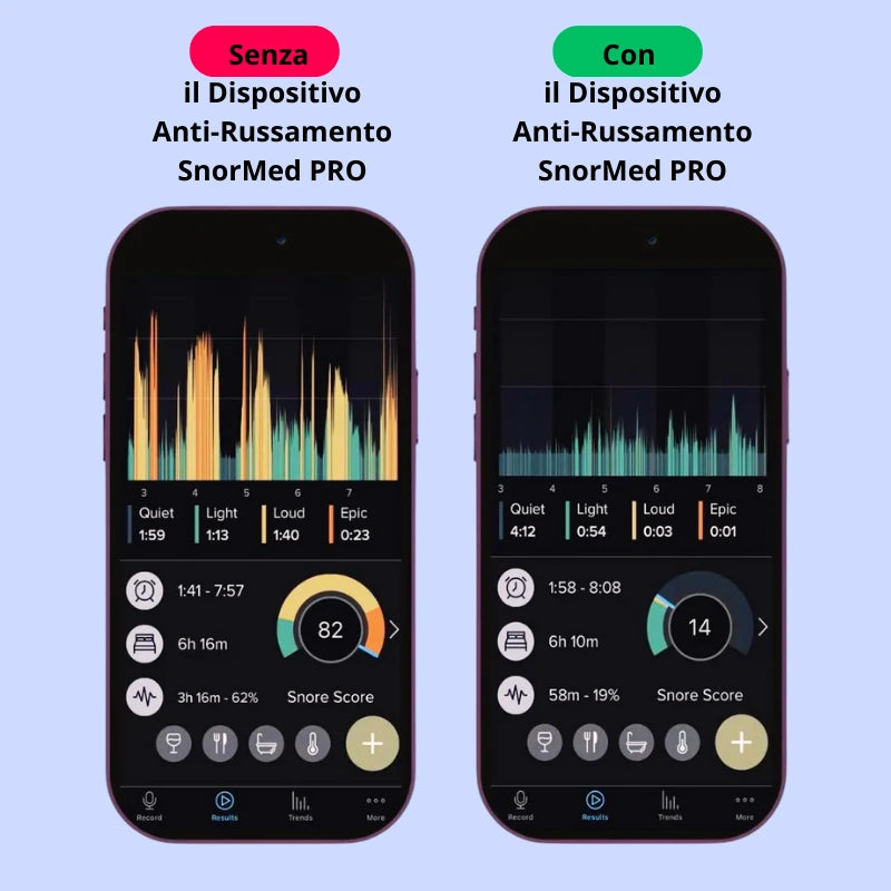 Dispositivo antirussamento SnorMed™ PRO