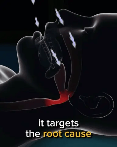 Slumberbetter Anti-snore Mouthpiece (Tiktok Viral)