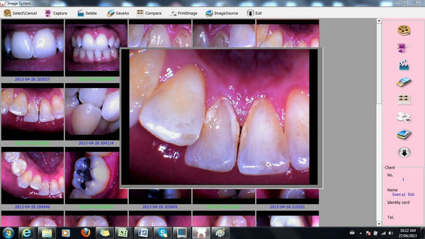 kodak dental imaging software installation 6.1