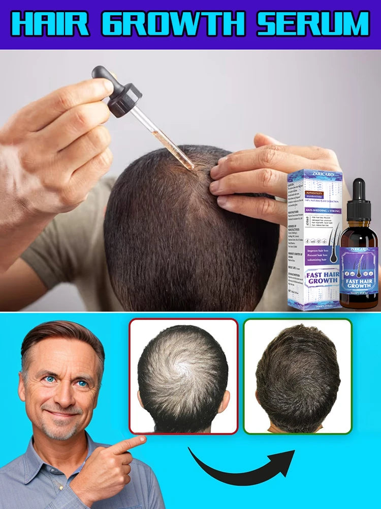 98% of buyers buy again, have more and more hair, say goodbye to baldness, thick hair,Hot selling product.