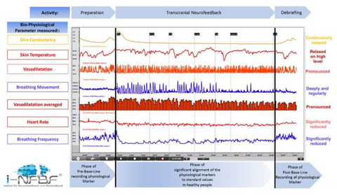 mcn micro current neurofeedback utah