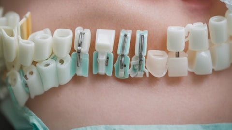 What Are Dental Bib Clips and Why Are They Essential in Dentistry?