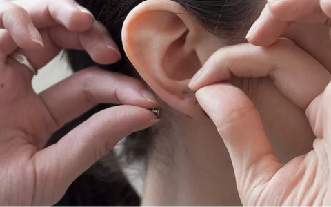 Bấm lỗ tai bị chảy mủ: Nguyên nhân và cách điều trị