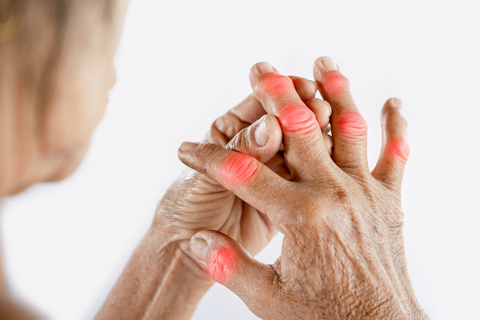 woman with gout touching finger joints with arthritis