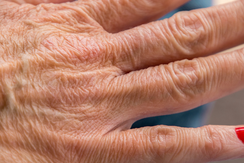 Hand with wrinkled skin