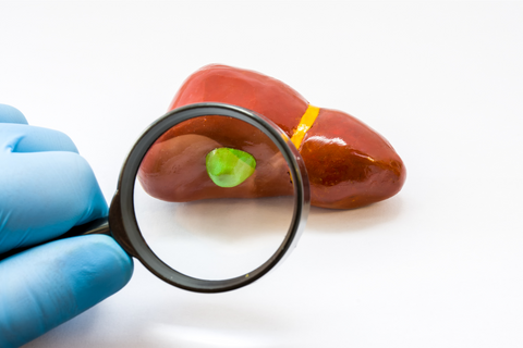 Gallbladder under a magnifying glass