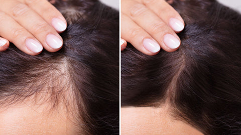 before and after msm powder for hair growth on scalp line