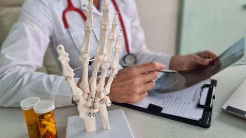 skeletal hand on doctor's desk for osteoarthritis