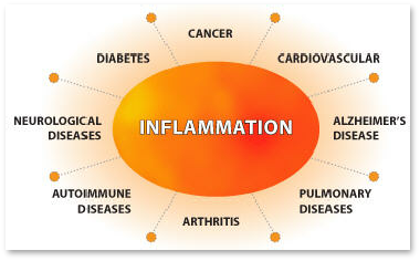 ginger root essential oil for inflammation & pain