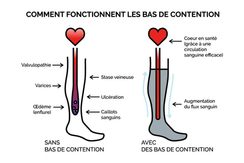bas-de-compression