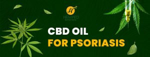 CBD oil for psoriasis